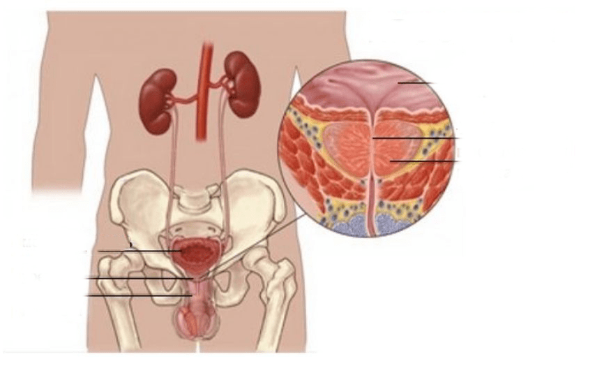 prostatitis pri moških