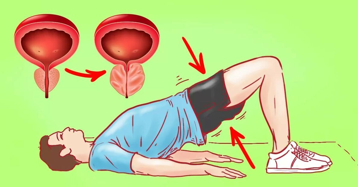 Vaje za prostatitis